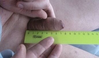 measuring the size of the penis
